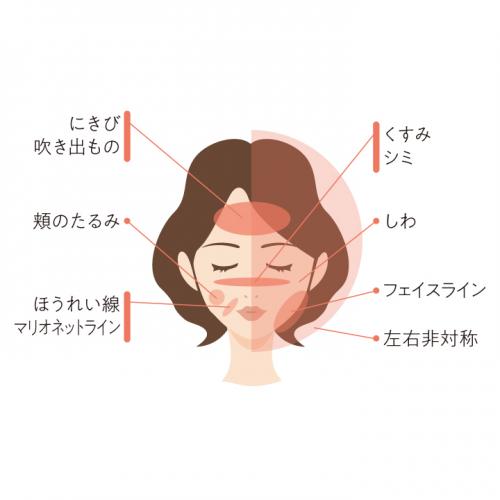 当てはまるお悩みは是非お試しください！(お顔の美容)